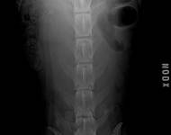 (5) typ 3 páteř VD